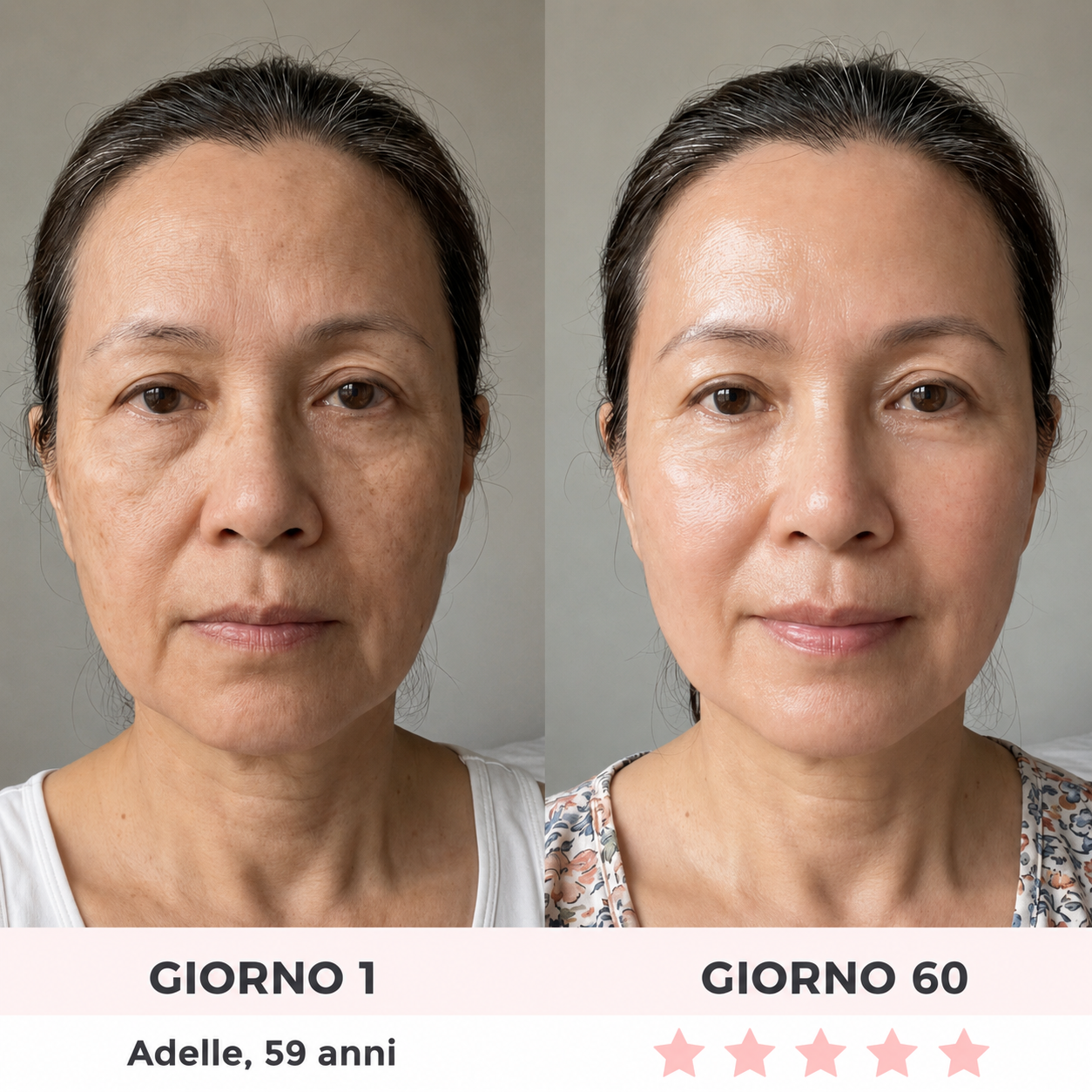Silver Rose | Maschera Viso LED 7 in 1